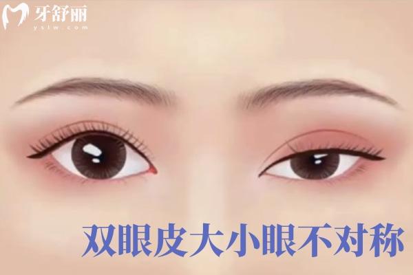 田國靜做眼袋修復(fù)怎樣?分享田國靜眼修復(fù)技術(shù)特色和田國靜眼修復(fù)價(jià)目表