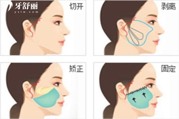 鄭州面部提升好的醫(yī)生有哪些