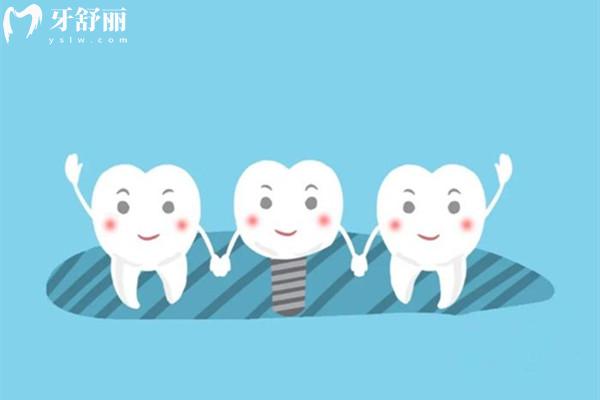 福州種植牙價(jià)格表