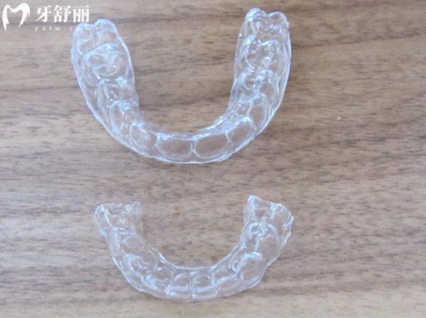 煙臺(tái)牙齒矯正價(jià)格表
