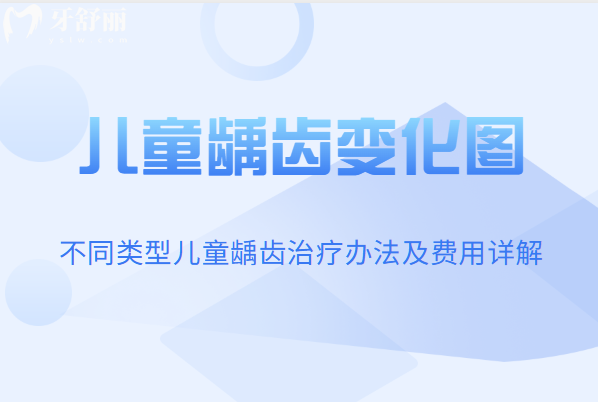 兒童齲齒變化圖一覽 淺齲/中齲/深齲不同類型兒童齲齒治療辦法及費(fèi)用詳解