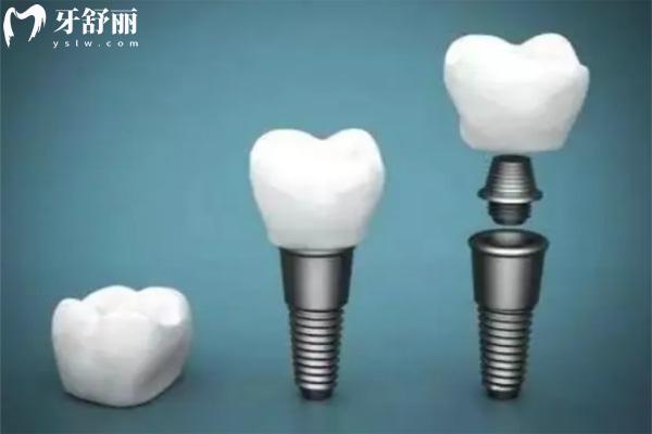 深圳登特口腔