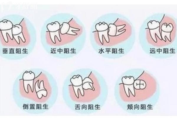 青州拔牙哪里實(shí)惠？