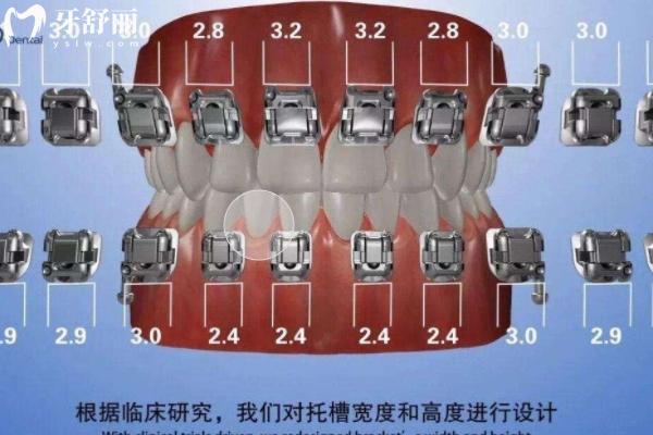 2025上海牙套價目表更新