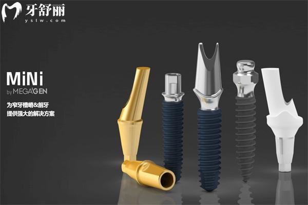 怎么知道自己用的種植牙是真的?種植牙真?zhèn)尾樵兗记蓪W(xué)起來!