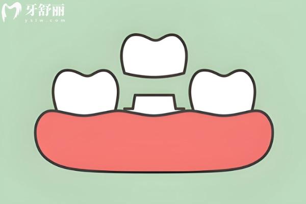 廣州看牙醫(yī)院哪家比較好