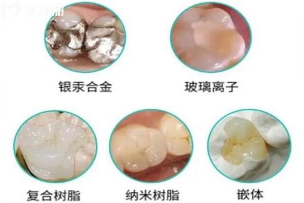 2025壹顆芽口腔醫(yī)院收費(fèi)明細(xì)表已出 山東正規(guī)牙科價(jià)格透明種牙矯正不貴