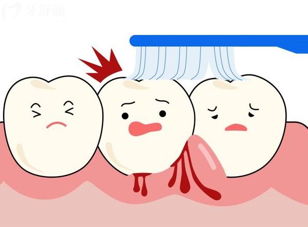 泰安口腔醫(yī)院牙周治療價格表