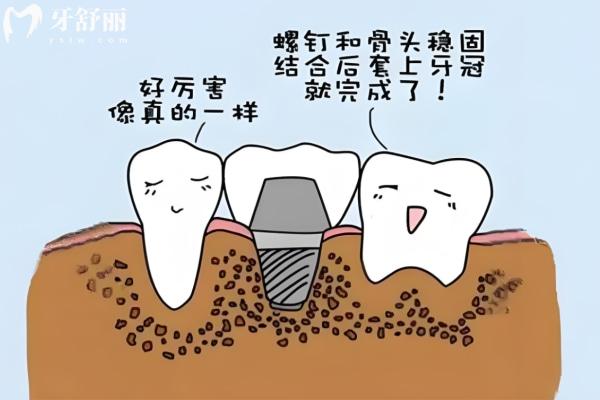 上海民營口腔醫(yī)院排名前十 疑難種植/數(shù)字化種植/即刻種植這幾家技術(shù)很可靠