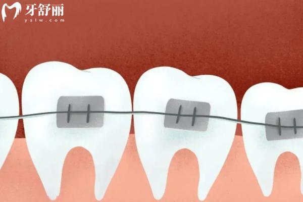 長(zhǎng)春牙齒矯正醫(yī)院哪家好？