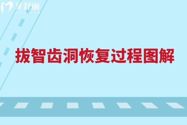 拔智齒洞**過程圖解