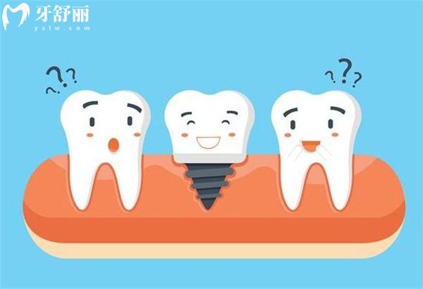 濟寧口腔醫(yī)院種植牙價格