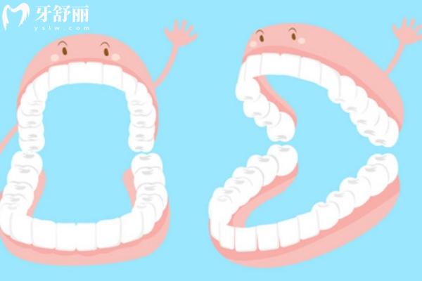 吸附性義齒到底好不好？