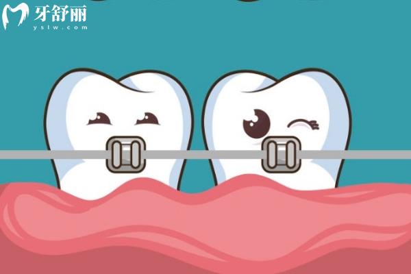 洛陽(yáng)哪里矯正牙齒比較好