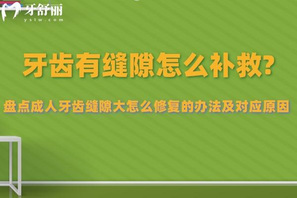牙齒有縫隙怎么補(bǔ)救 盤點成人牙齒縫隙大怎么修復(fù)的辦法及對應(yīng)原因