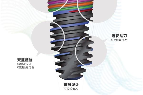 2025種植牙價格一覽表圖分享!韓國牙/美國牙/諾貝爾/ITI等國產(chǎn)進口植體價格盤點