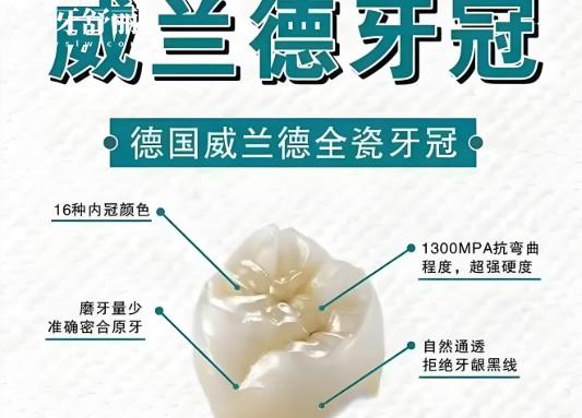 威蘭德牙冠有哪些型號