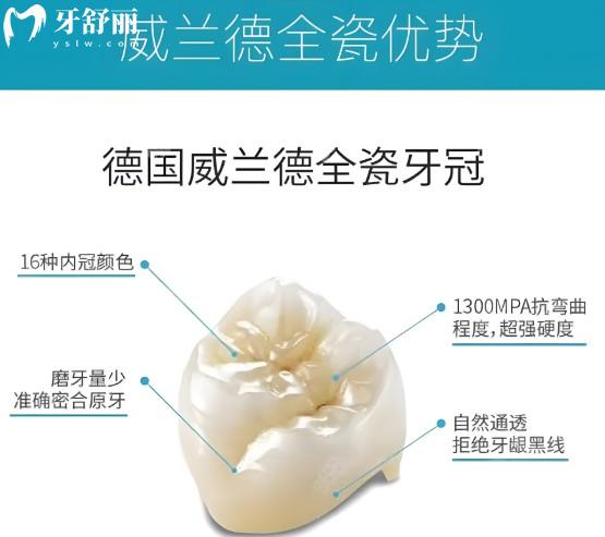威蘭德牙冠有哪些型號