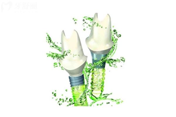 種植牙什么品牌的好？國產(chǎn)/韓國/歐美等熱門品牌分享