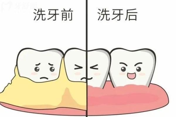 咸陽洗牙哪家醫(yī)院好？