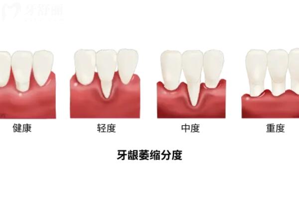 2025寶雞口腔醫(yī)院收費(fèi)標(biāo)準(zhǔn)