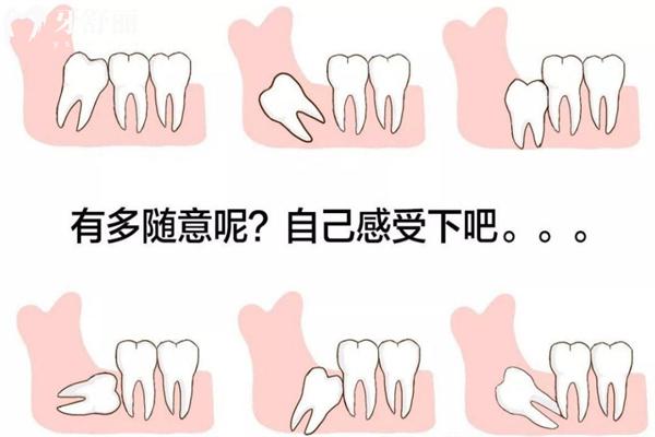 東莞牙科2025收費價目表:包含東莞口腔醫(yī)院種植牙