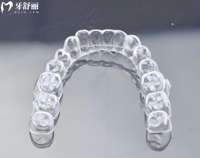 可麗爾博士隱形矯正質(zhì)量咋樣