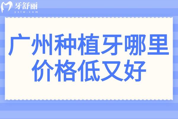 廣州種植牙哪里價(jià)格低又好?曙光