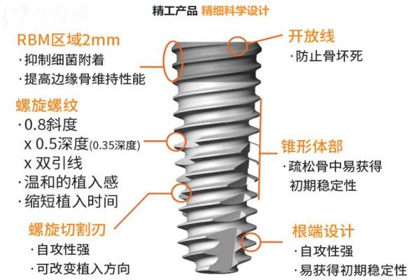 奧齒泰種植牙屬于什么檔次?盤點(diǎn)這款韓國(guó)十大植體品牌的質(zhì)量/使用壽命/價(jià)格可知