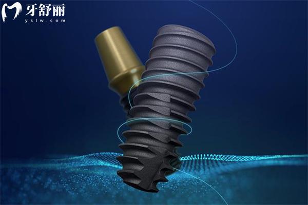 奧齒泰種植牙屬于什么檔次?盤點(diǎn)這款韓國(guó)十大植體品牌的質(zhì)量/使用壽命/價(jià)格可知