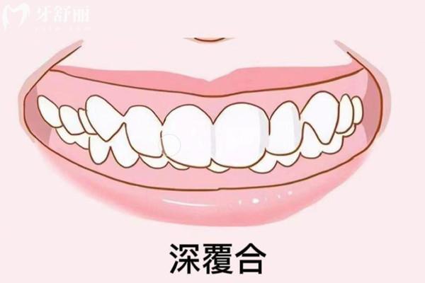 牡丹江牙齒矯正價目表