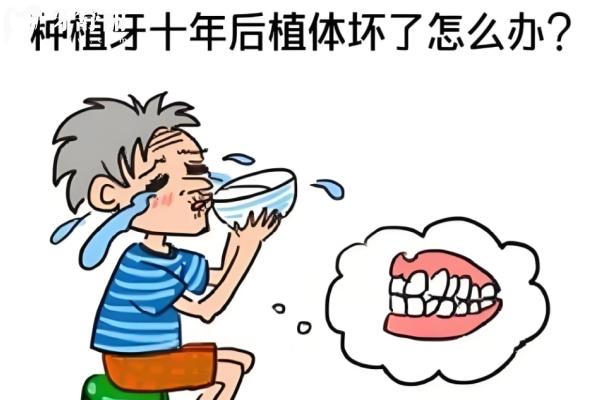 南京哪家種牙便宜又好?這10家醫(yī)院技術(shù)靠譜價格實(shí)惠賊靠譜！