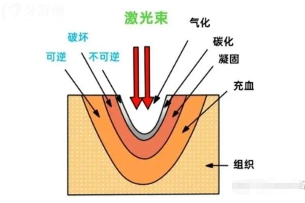 大連金州哪家弄牙便宜又好？