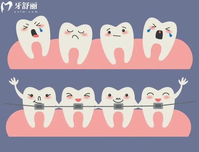 慈溪口腔醫(yī)院牙齒矯正價格