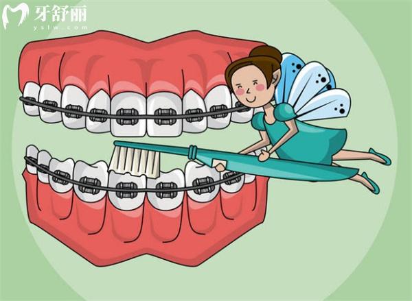 石家莊口腔醫(yī)院牙齒矯正費(fèi)用