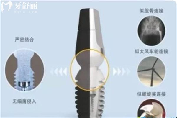 福州牙科醫(yī)院種植牙多少錢一顆 價格表中單顆2000-12000元收費(fèi)不等  