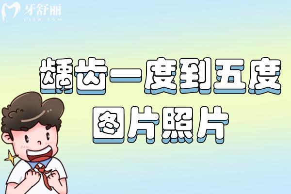 齲齒一度到五度圖片照片