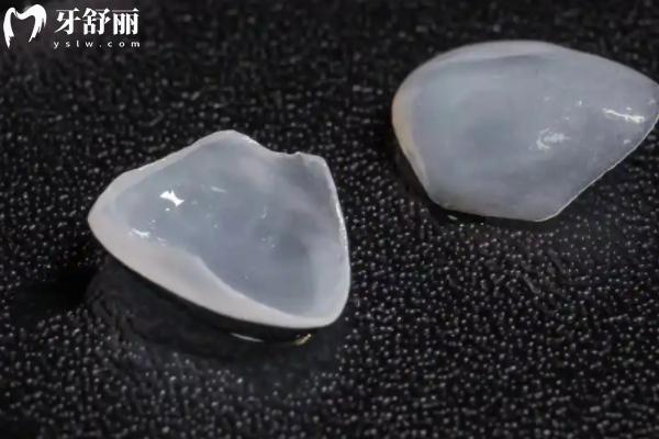 包頭幸?？谇会t(yī)院是正規(guī)醫(yī)院嗎