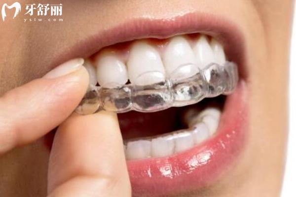 宜春施美爾口腔收費(fèi)標(biāo)準(zhǔn)，補(bǔ)牙、種植、矯正、根管、拔牙等收費(fèi)全知曉