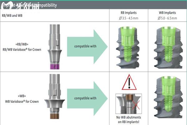 瑞士士卓曼BLX種植體