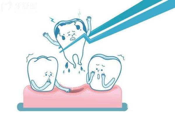 2025年正規(guī)醫(yī)院拔智齒收費標(biāo)準(zhǔn)一覽表:上頜400+下頜500+垂直阻生600+埋伏阻生1000+