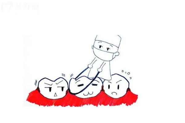 2025年正規(guī)醫(yī)院拔智齒收費標(biāo)準(zhǔn)一覽表:上頜400+下頜500+垂直阻生600+埋伏阻生1000+