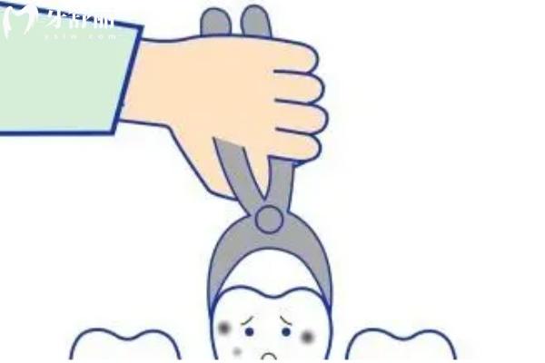 2025年正規(guī)醫(yī)院拔智齒收費標(biāo)準(zhǔn)一覽表:上頜400+下頜500+垂直阻生600+埋伏阻生1000+