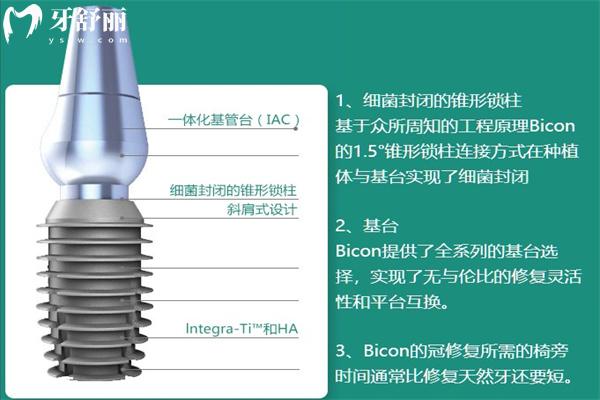 美國種植牙一顆多少錢