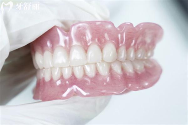 吸附性義齒與普通義齒區(qū)別圖片對(duì)比:固定方式/舒適度/使用壽命/價(jià)格差一覽可知