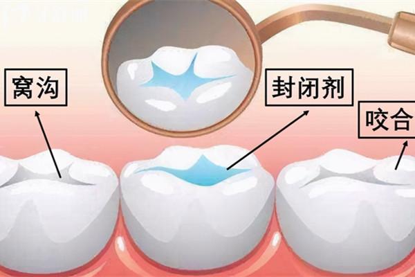 永州看牙多少錢