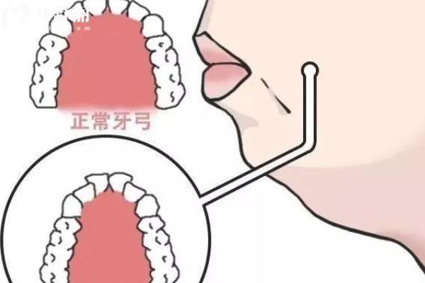 北京舌側(cè)矯正哪個(gè)醫(yī)生好？
