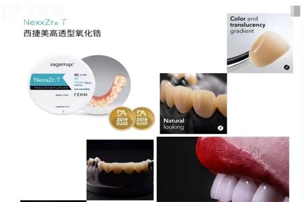 義獲嘉西捷美全瓷牙硬度多少?一覽義獲嘉全瓷冠型號大全及價格便知