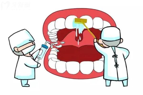 牙周炎會(huì)傳染嗎？不一定，分享牙周炎的預(yù)防與治療