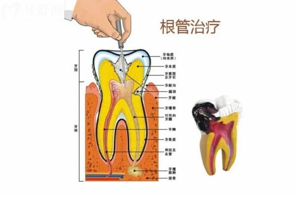 2025寧波口腔醫(yī)院價(jià)目表:當(dāng)?shù)厝嗽u價(jià)實(shí)惠正規(guī)的牙科及價(jià)格表快收好